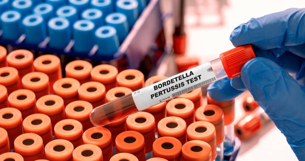 éprouvette de test bactérie bordetella pertussis