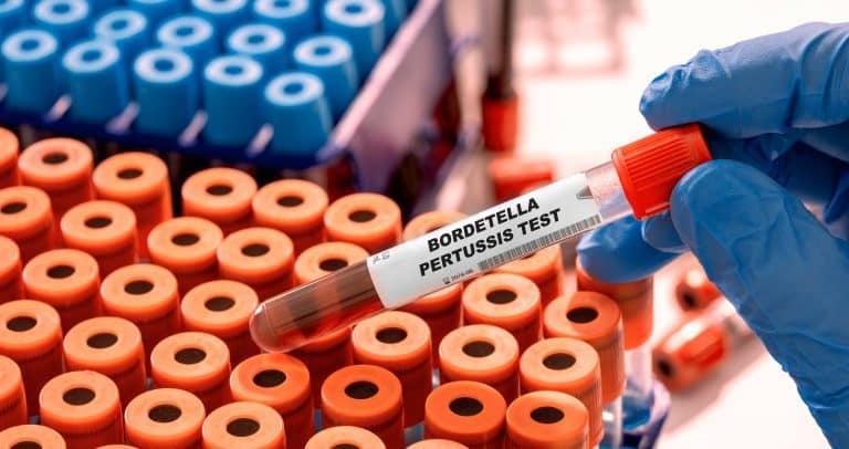 éprouvette de test bactérie bordetella pertussis